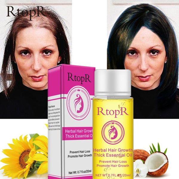 

fast powerful hair growth essence hair loss products essential oil liquid treatment preventing hair loss care 20 wmtggu