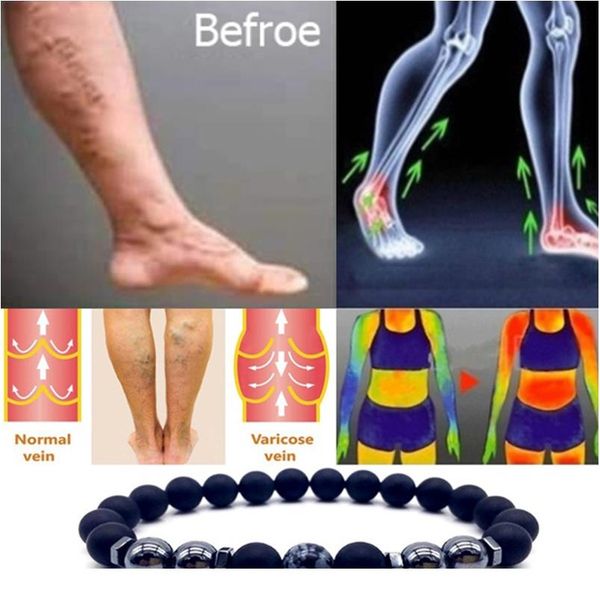 

магнитный браслет красочный камень восемь потерь магнитная терапия браслет продукта для похудения здравоохранения sqcvxf, Red;blue