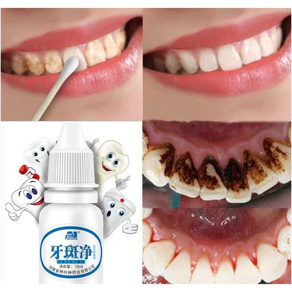 

essence tooth whitening pen dazzling white instant teeth remove plaque stains clean oral hygiene care whitening toothpaste 2020 wmtchs