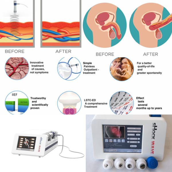 

portable low intensity acoustic radial shock wave therapy for ed treatment/ed shock wave therapy machine for erectile reduction
