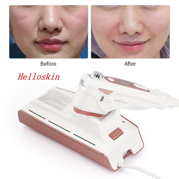 Ultrasuoni portatili Ultrasuoni HIFU Macchina Helloskin Face Lifting Skin Stringere Anti Invecchiamento Rimozione delle rughe Macchina di bellezza Uso domestico del salone