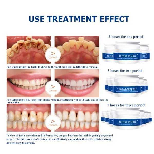 

отбеливание зубов урошок зубной пасты чистые пятна 30г яркие зубы острые уход за уходом для зубов острым уборкой свежий дыхание гигиена устн