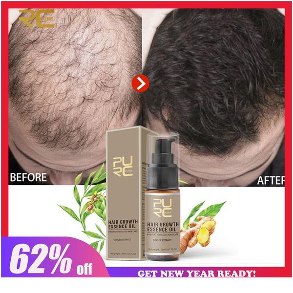 

purc fast hair growth essence oil hair loss treatment help for hair growth c wmttyu