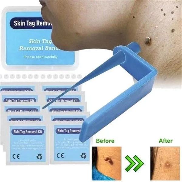 Тег кожи Убить кожи Мотовой моль Wart Remover Micro Band Кожа Удаление Удаление Кожа Удаление с Очищающимися Маленькими Уровень взрослых Уход за лицом