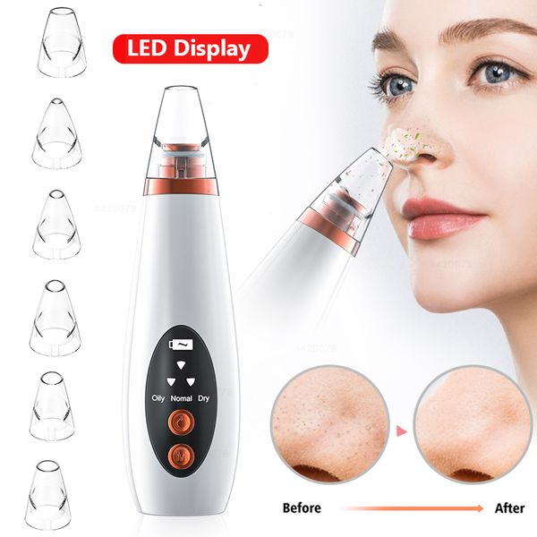 

usb rechargeable blackhead remover face pore vacuum skin care acne pore cleaner pimple removal vacuum suction facial tools