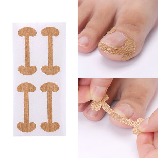 

20pcs/5 sheets toenail correction patch embedded toe nail corrector sticker toenail care pedicure thumb curl correction sticker