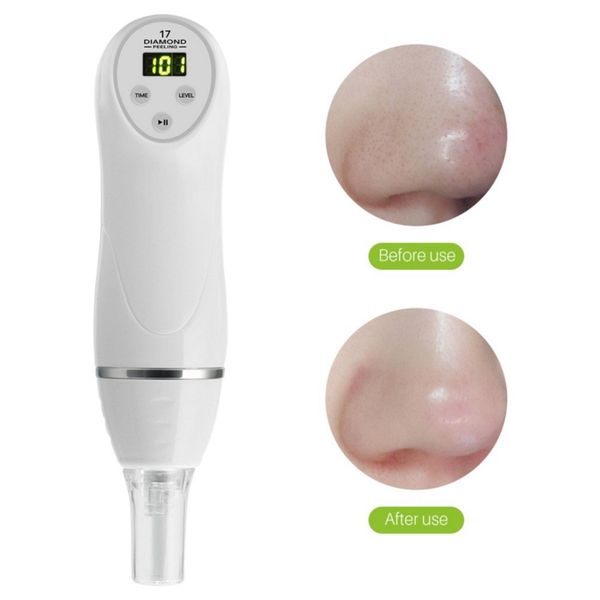 

latest portable diamond dermabrasion machine vacuum blackhead remover machine