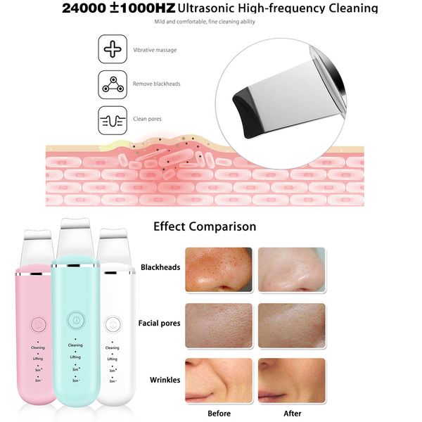

2021 ultrasonic skin scrubber peeling facial pore cleaner+face skin care vibration massage device eye lifting wrinkle removal