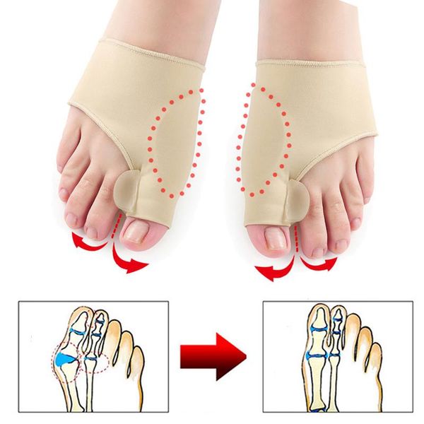 2pcs = 1 pair of toe separator hallux valgus valgus corrector orthopedic foot bone thumb adjuster correction pedicure socks straightener, Blue;black