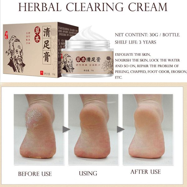 

new herbal anti-drying crack foot cream effective anti fungal moisturizing foot skin care foot care tool sn-hot
