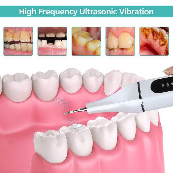 

sonic dental scaler electric tooth calculus remover tooth stains tartar plaqueteeth cleaner teeth whitening tool perfections