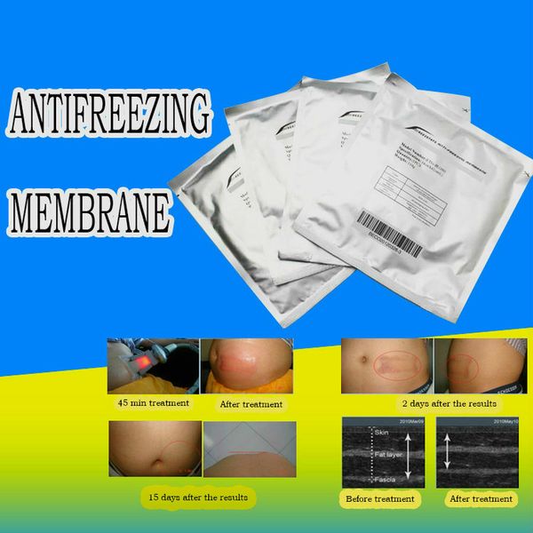 Accessori per strumenti di refrigerazione con membrana antigelo di alta qualità Dimensioni Cryo Pad per il trattamento del congelamento dei grassi Antigelo Pad096