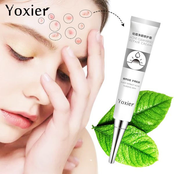

yoxier cleaning tools & accessories q acne cream stubborn tease blackhead skincare