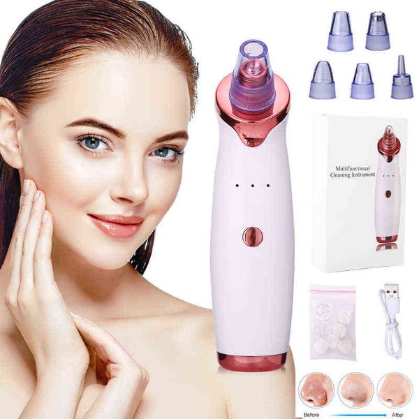 

nxy face care devices facial blackhead remover electric pore cleaner point vacuum tool spots machine 0222