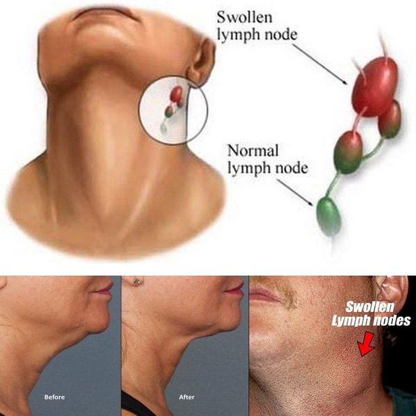 

10 pcs neck lymphatic detox patch anti-swelling herbal foot body relaxation can csv