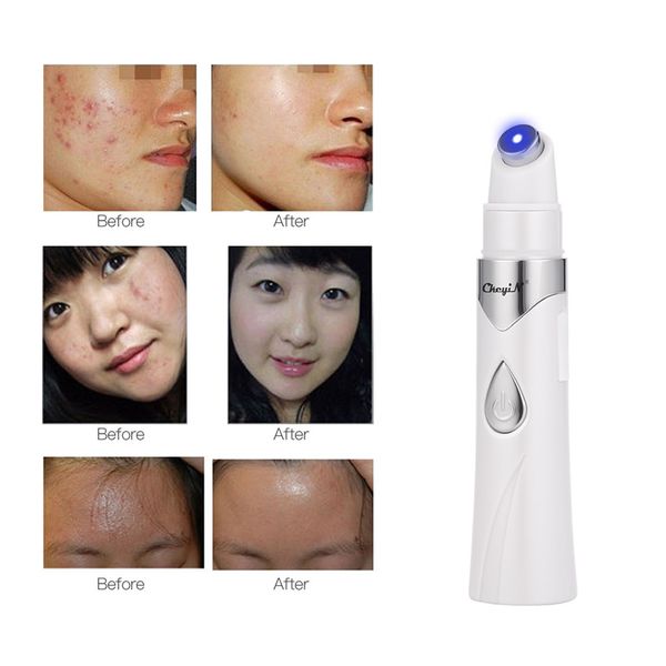 

usb charging blue led light therapy warm face eye skin anti wrinkle stick heated bio micro-current magnetic vibration eye care