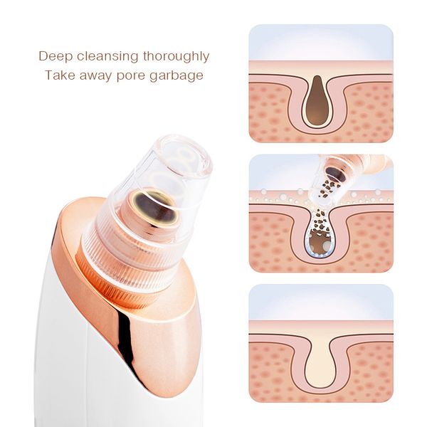 

beauty blackhead remover face deep pore vacuum acne cleaner for remove pimple skin tag nose cleansing instrument skin care tools