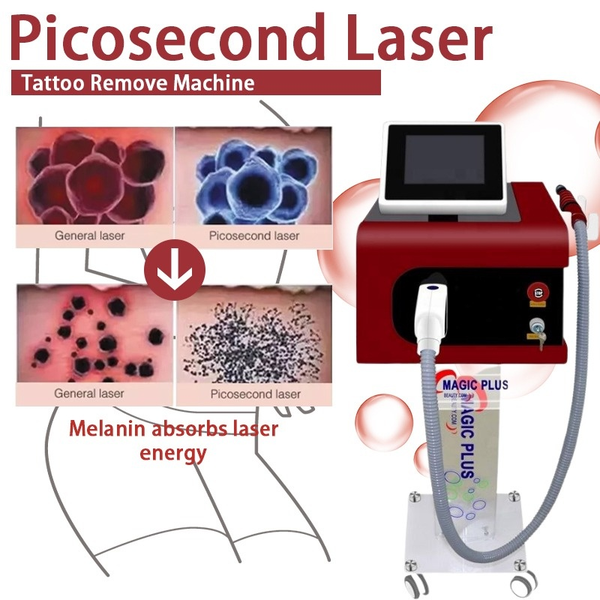 

laser 755 portable lazer tattoo removal device speckle removal freckles spots remove beauty machine up1q#, Black