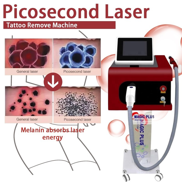 Laser 755 Tragbare Lazer Tattoo Entfernung Gerät Speckle Entfernung Sommersprossen Flecken Entfernen Schönheit Maschine Up1Q #