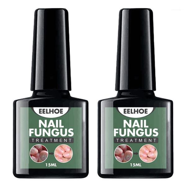 

2pcs oil natura essence liquid anti foot caring solutions nail gel1, Red;pink