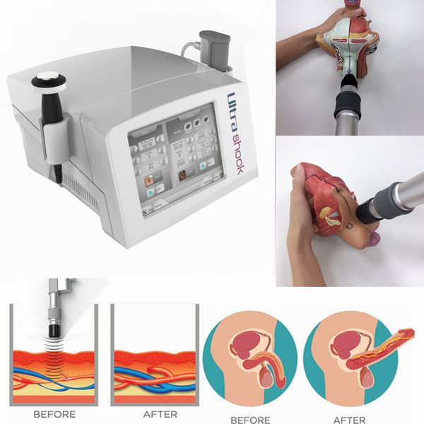 

portable full body pain arthritis ultrasonic shock wave physical therapy equipment for plantar fasciitis