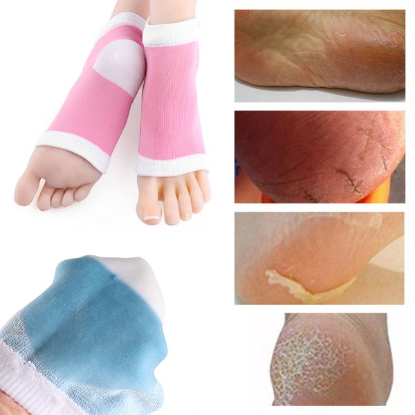 Silikon Feuchtigkeitsspendende Gel Ferse Socken Handschuhe Wiederverwendbare Anti Rissige Rissige Fuß Glatte Hautpflege Peeling Füße Schutz Werkzeuge