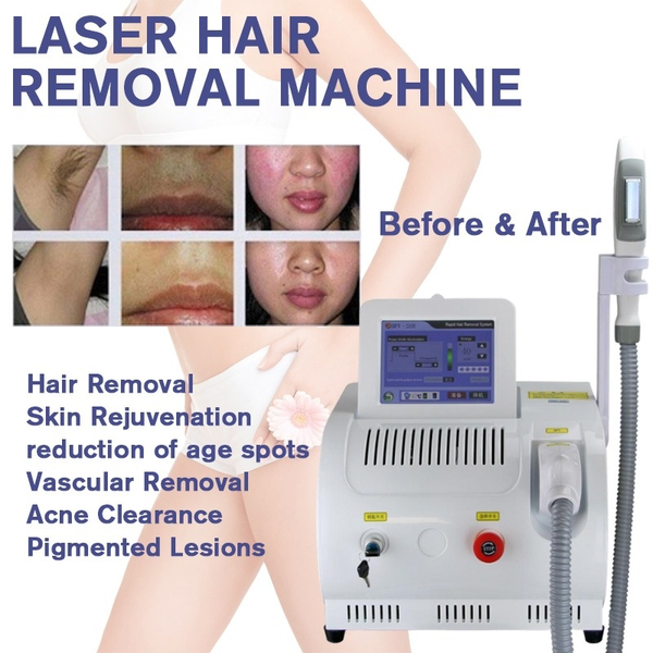 

ing point fast buttocks back hair removal lazer ipl machine opt rf skin rejuvenation acne spot reduction device390
