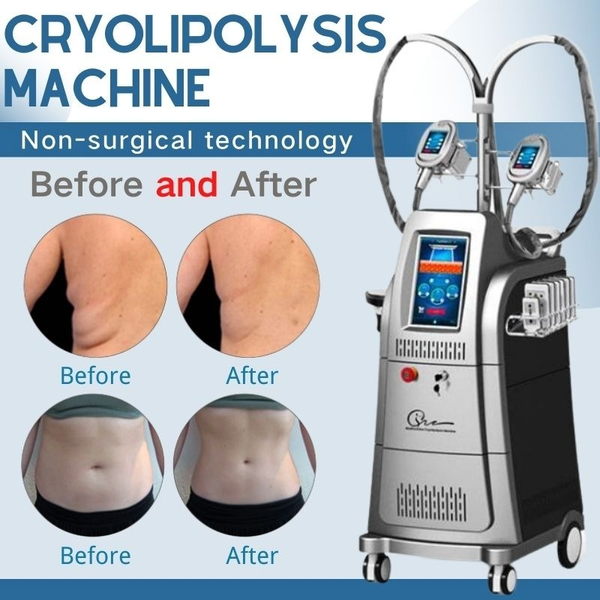 

factory e fat lipo cryo body shaping slimming cryo lipolaser machine for sale beauty equipment criolipolisis portable machines