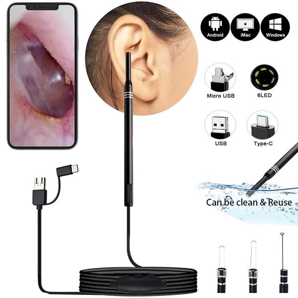 

3 in 1 earpick endoscope multifunctional usb ear cleaning tool hd visual earcare spoon clean2m medical otoscope digital for android phone pc