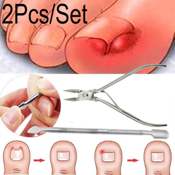 

nail art kits 2pcs/set ingrown toe correction nippers clipper cutters dead skin dirt remo remover scissor plier pusher tool trimmer