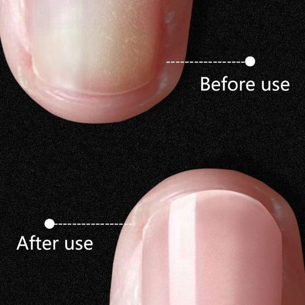 

nail art kits y1uf 15ml tearable base coat polish varnish for nails manicure lacquer decoration