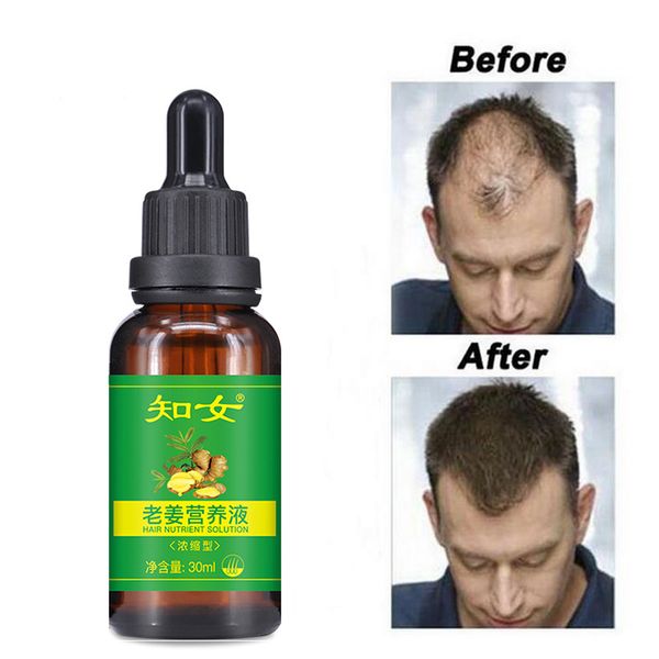 

fast hair growth essence oil hair loss treatment help for hair growth care