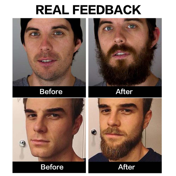 

3pcs beard oil for men anti hair loss grow mustache essence oil thicker fuller mens natural ingredients beard growth oil 60mlscouts