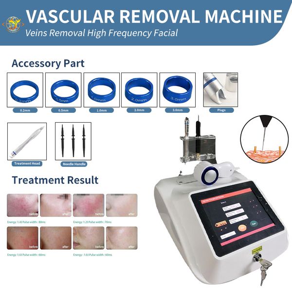 

980nm diode laser spider vein removal telangiectasias vascular lesion, Black