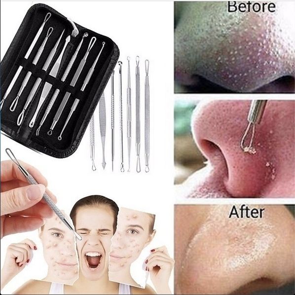 

dhl 7pcs blackhead remover tool kit facial pimple removal tools blemish extractor acne needle clip tweezer set face skin care