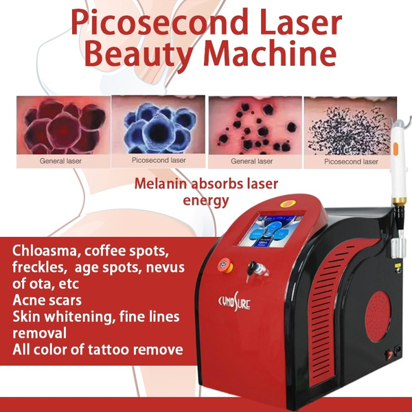 Neue Pico Laser Mark Tatoo Entfernung 755 Nm 532 Nm 1064 Nm Laser Maschine Für Pigmentierung