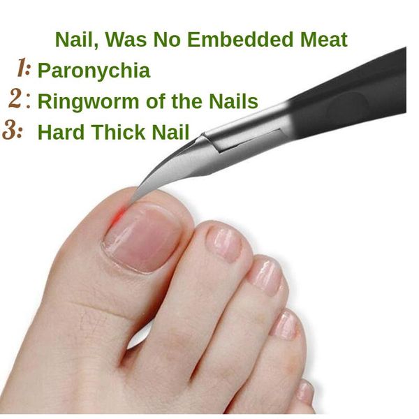 

nail art kits 1-3pcs/set stainless steel olecranon clippers, dead skin scissors, toe repair tools
