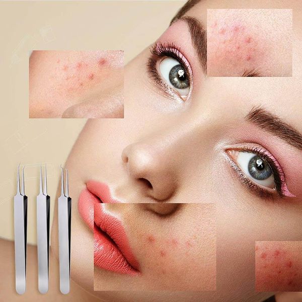 

eyebrow tools & stencils 3 pcs stainless steel blackhead remover tweezers professional comedone extractor set ma