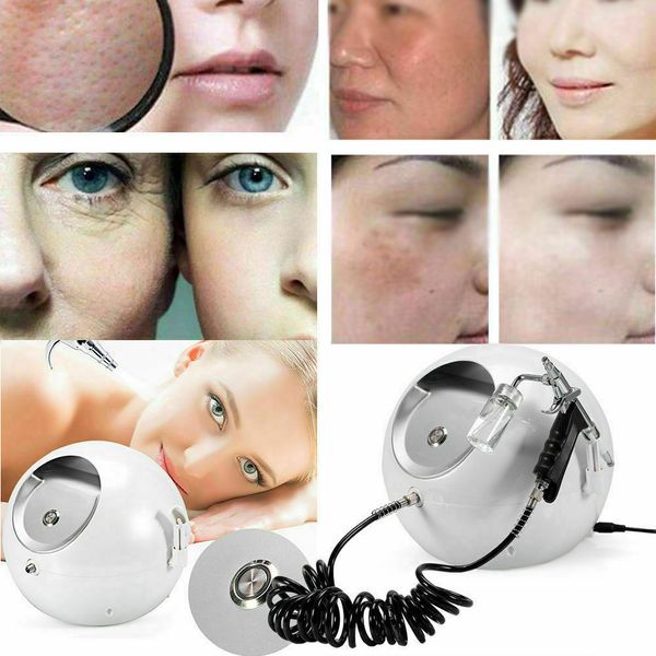 

portable mini o2 oxygen jet peel water spray skin rejuvenation acne removal face care machine for home use, Black;white