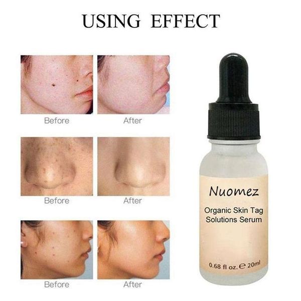

cleaning 20ml organic skin spot purifying serum natural mole tag removal care