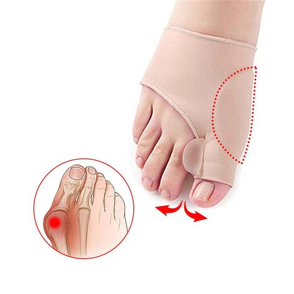 

2pcs big bone orthopedic bunion correction pedicure socks silicone hallux valgus corrector braces toes separator feet care tool ankle suppor, Blue;black