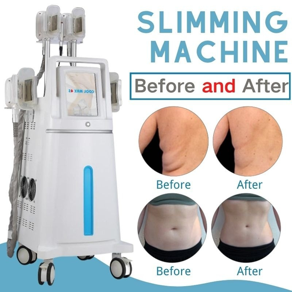 

2022 new cryolipolysis e fat machine cryotherapy body slimming slim loss cryo care