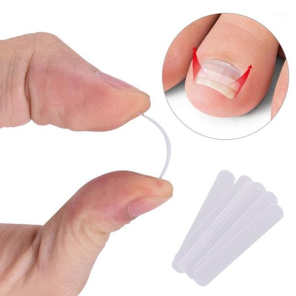 

ingrown toenail pedicure tool 10pcs/bottle straightening clip curved bs brace toenails thick correction foot1