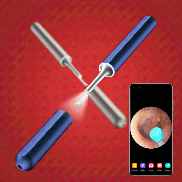 

cameras bebird x17 pro smart visual ear cleaning rod earstick otoscop high precision magnetic charging base