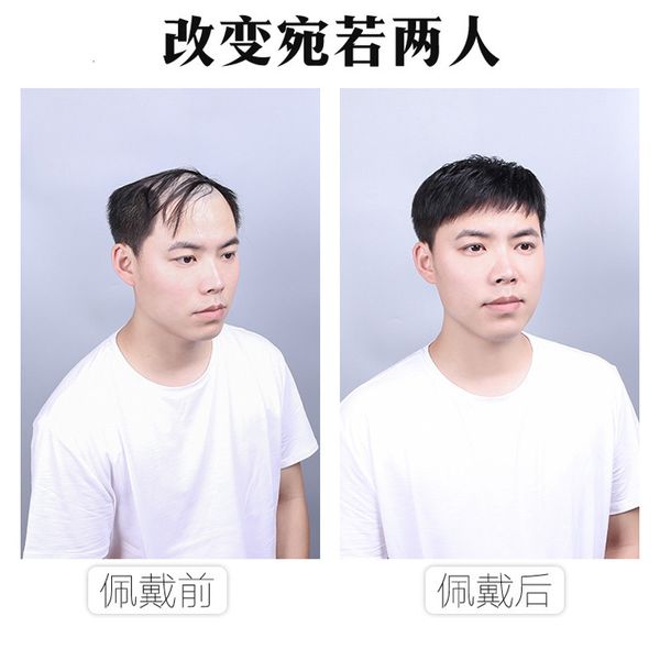 

forehead real baldness patch wig cover men's short hair piece, Black