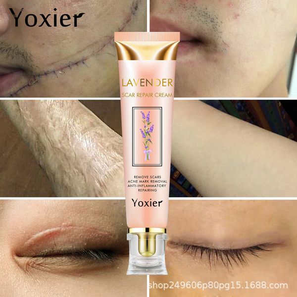 

yoxier lavender scar repair cream cleaning tools & accessories