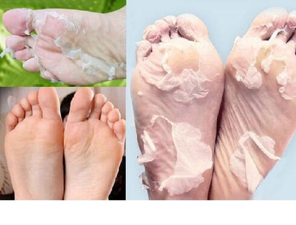 DHL heißer Verkauf Essig Entfernen Sie abgestorbene Haut Foot Skins glatte Peeling Füße Maskenpflege