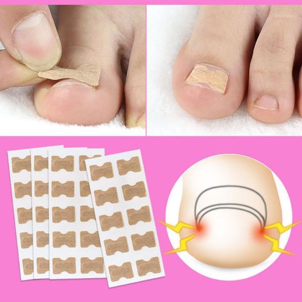 

10-50pcs nail sticker toenail toe ingrown correction patch art glue tslm11, Black
