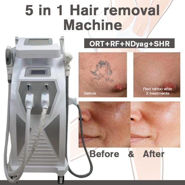 Profissional multifuncional OPT HR IPL Depilação a Laser ND YAG Laser Tattoo Removal Beauty Machine 5 Em 1 IPLRFND YAGElight CE/DHL