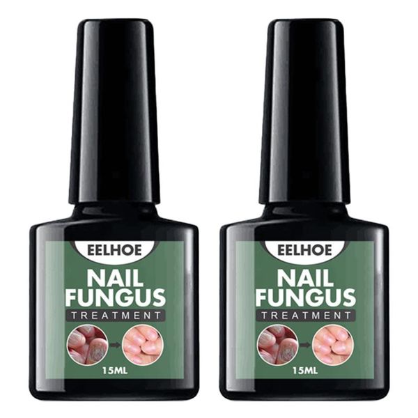 

2pcs oil natura essence liquid anti foot caring solutions nail gel, Red;pink